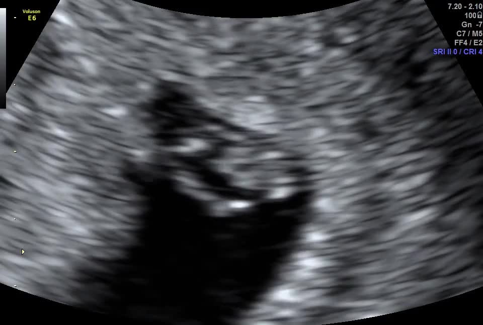 Watch unnamed | Streamable