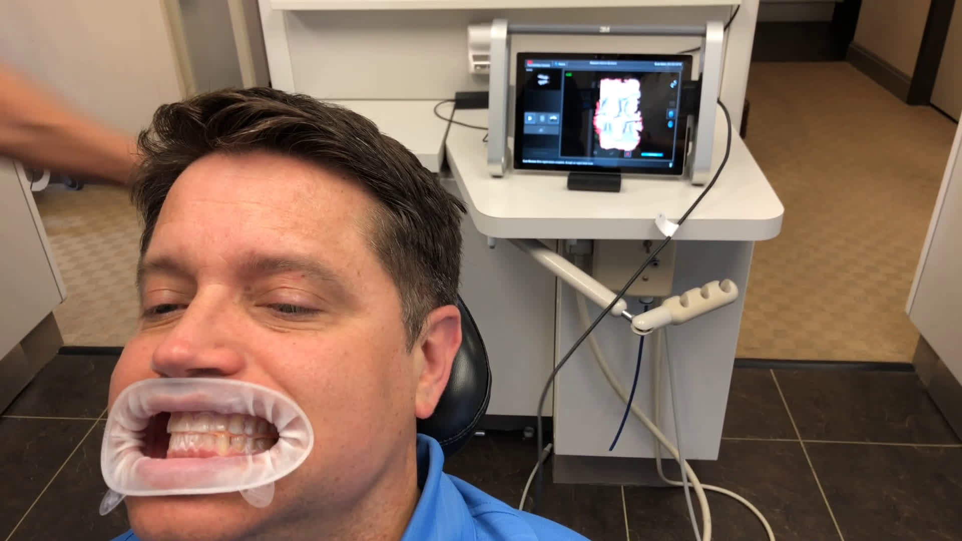 How To Scan A Myobite