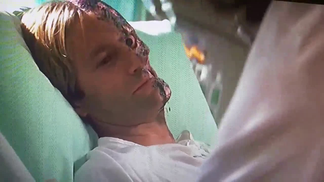 A great moment in movie history is when Harvey can't recognize The Joker  until he takes off his surgery mask. : r/videos