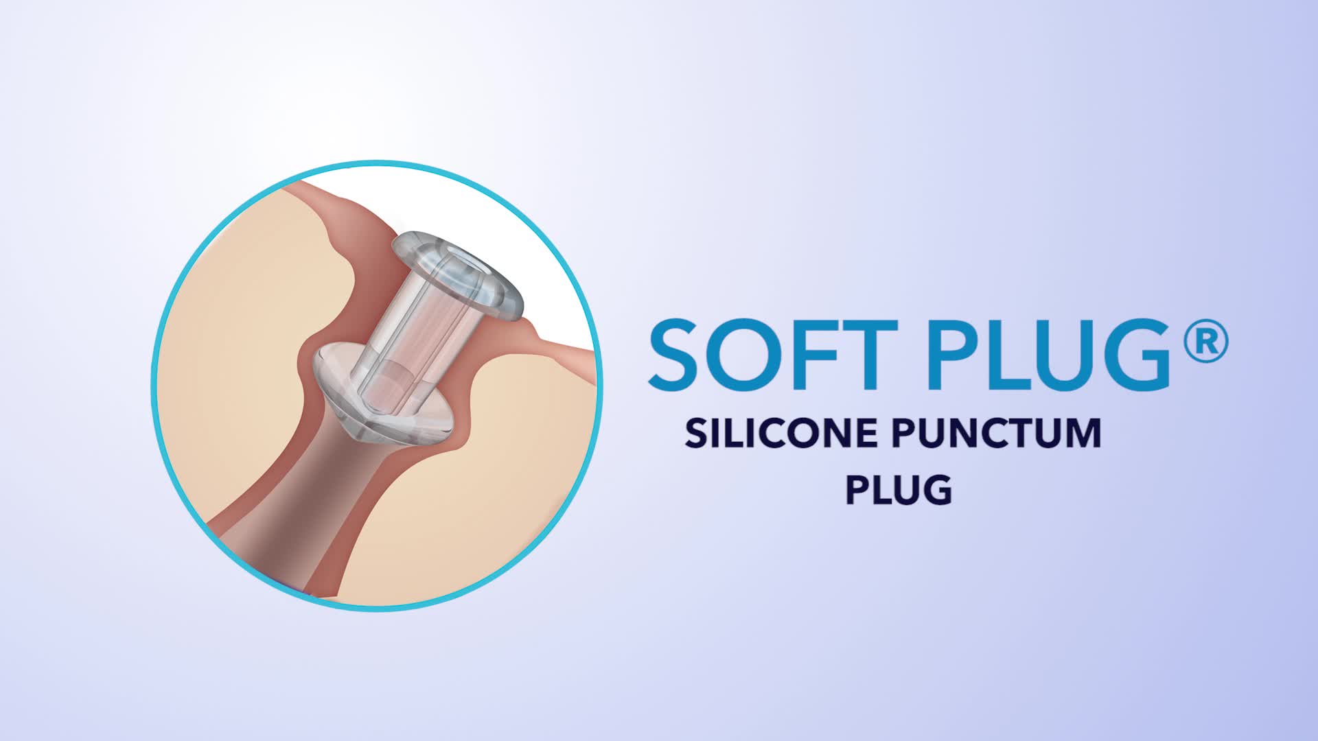 Watch SOFT PLUG® Silicone Plug Instructions For Use Video | Streamable